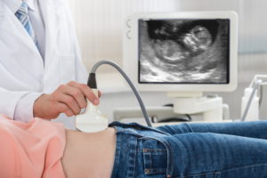 Определение беременности до 10 дней в Запорожье
